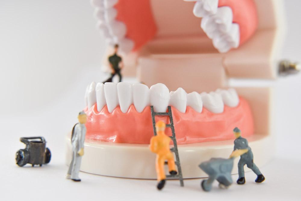 Limpeza nos dentes: de quanto em quanto tempo precisa fazer?