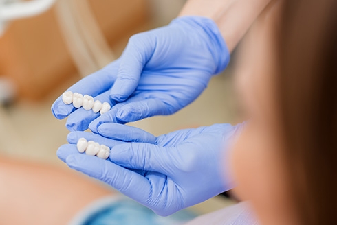 Facetas de porcelana e lentes de contato: qual a diferença?