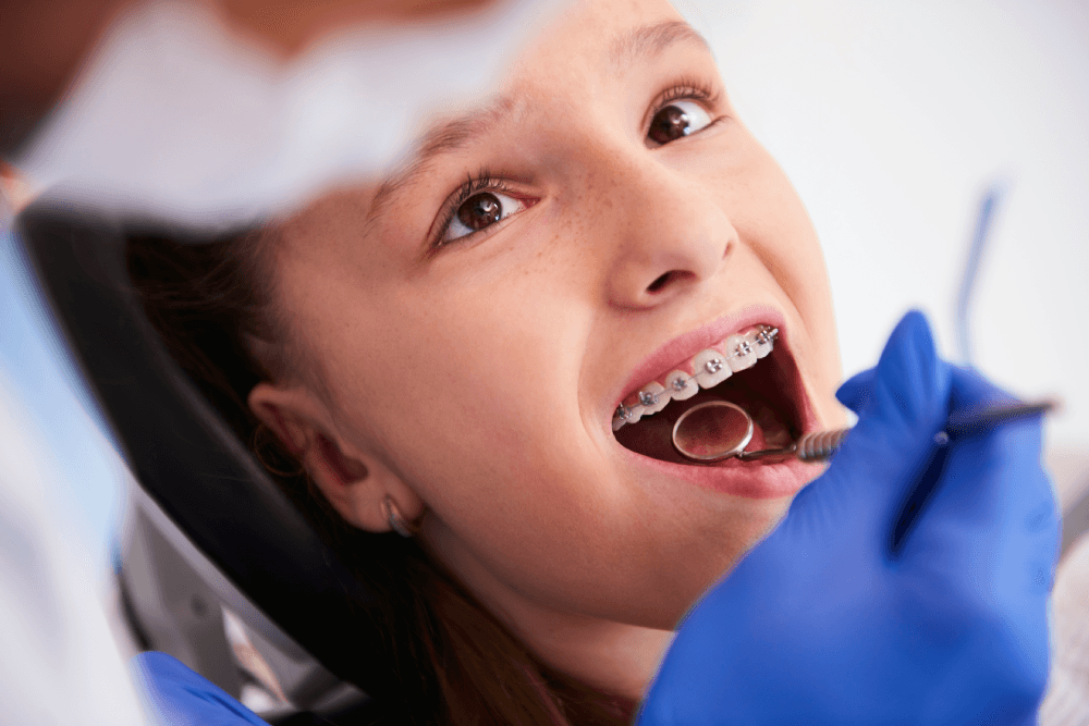 A partir de qual idade pode colocar implantes dentários?