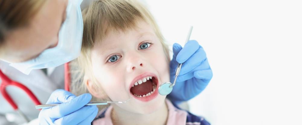 5 cuidados para evitar a cárie em crianças