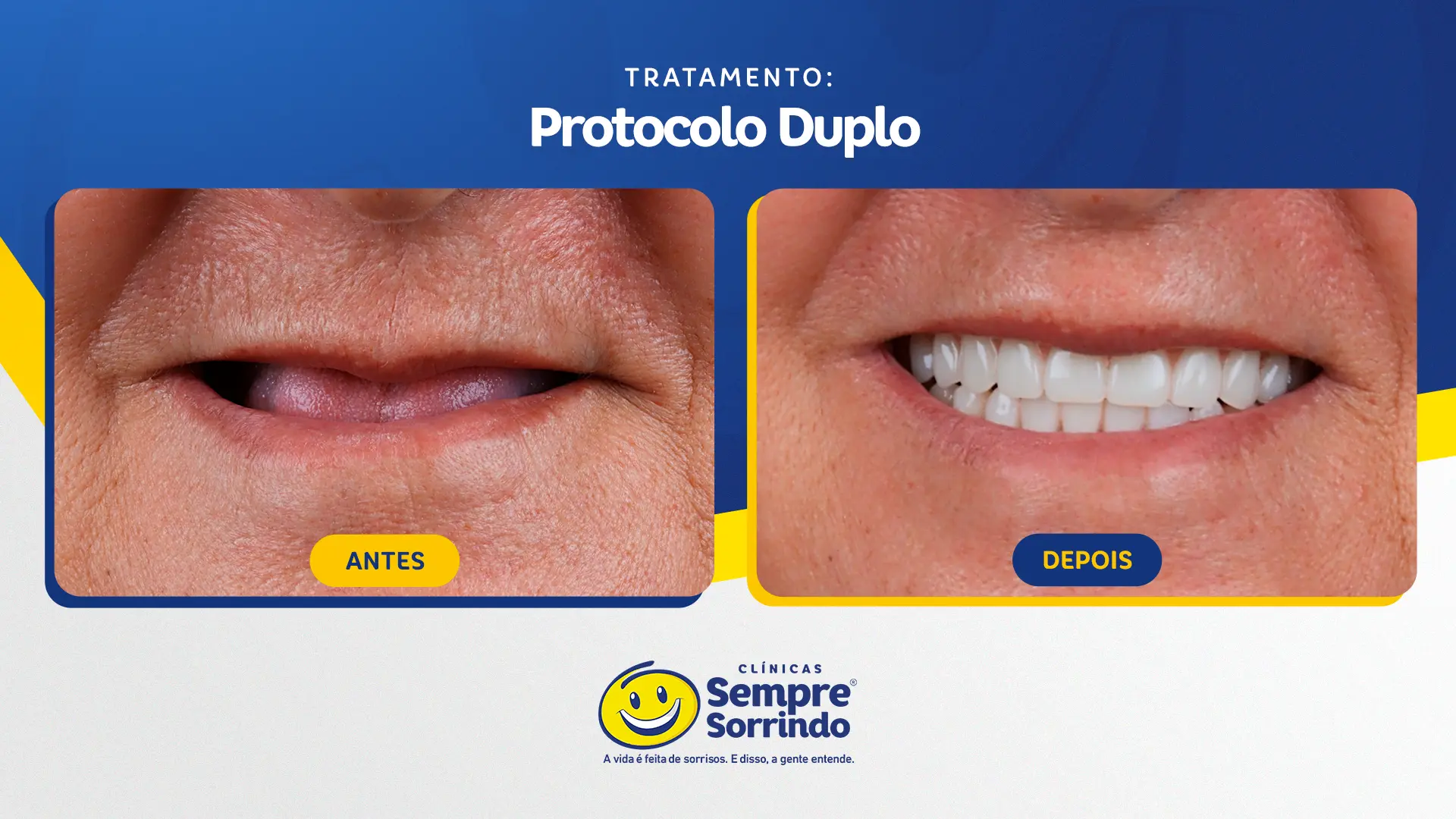 foto de antes e depois do sorriso de um dos pacientes.