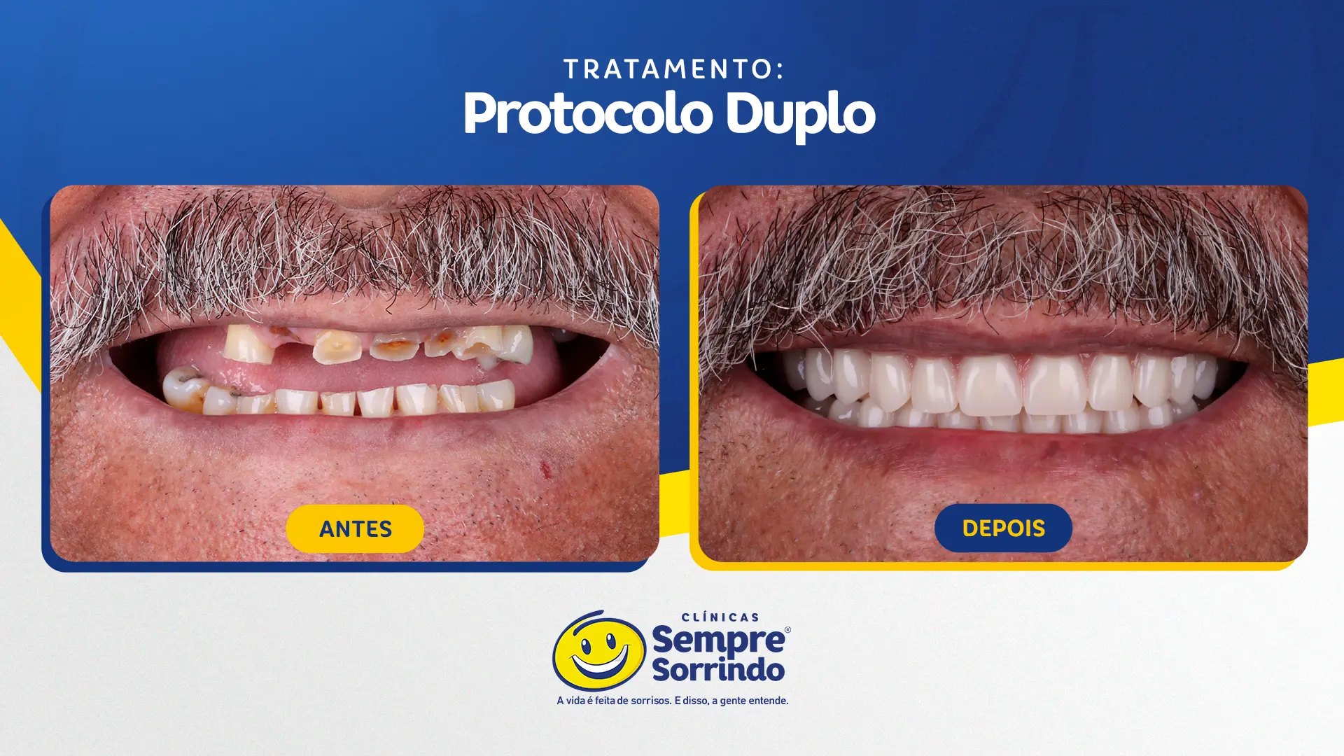 foto de antes e depois do sorriso de um dos pacientes.